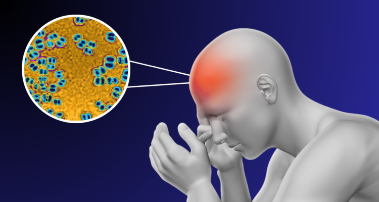 ¿Qué es la meningitis y cómo se contagia? Se ha detectado una decena de casos en Chile