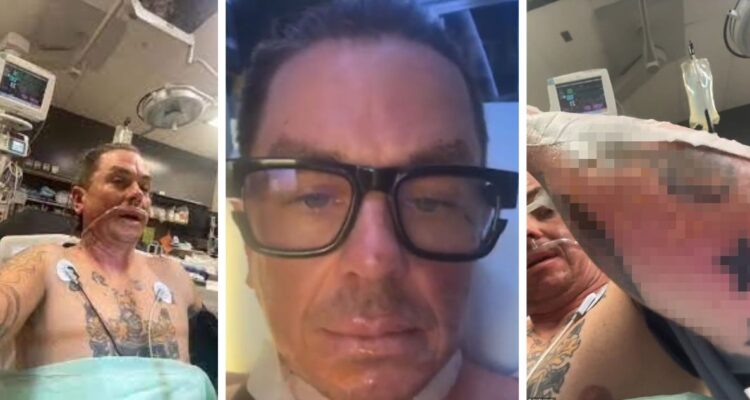 El DJ de Slipknot Sid Wilson sufrió graves quemaduras tratando de prender una fogata ¿vendran a su concierto en Chile y el Knotfest?