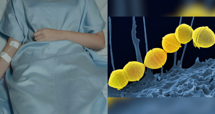 Streptococcus Pyogenes, la “bacteria asesina”: ¿qué provoca y qué tan grave es realmente?