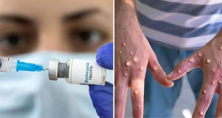 Quiénes, cuándo y cómo deben vacunarse o recibiri la vacuna contra la viruela del mono en Chile y cuál es la población objetivo.