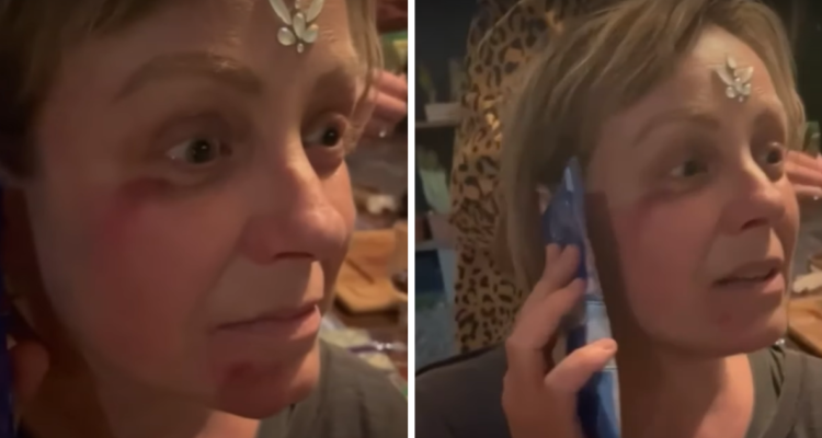 Conductora de televisión, Claudia Conserva, relata doloroso accidente con su perro durante celebración del 17 de septiembre.