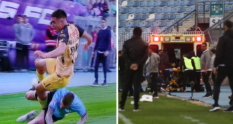 Coquimbo Unido reveló diagnóstico de lesionado jugador Enzo Mettifogo.