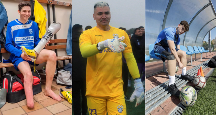 Los casos que ilusionan a Cristóbal Campos con volver al fútbol con una prótesis.