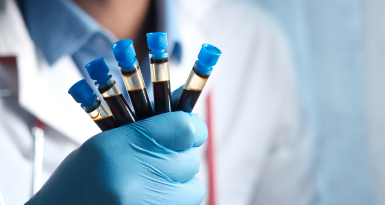 Cientifico sosteniendo muestras de sangre en referencia nuevo grupo sanguíneo