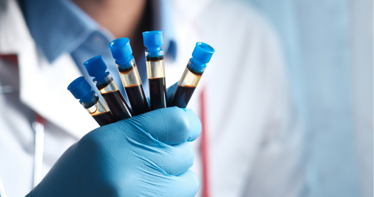 Cientifico sosteniendo muestras de sangre en referencia nuevo grupo sanguíneo