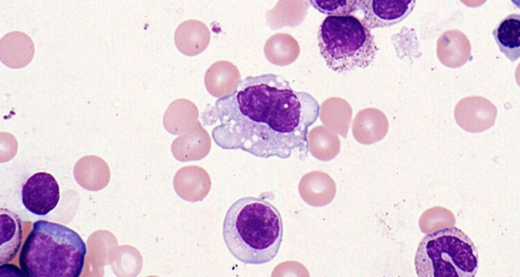 Imagen referencial sobre el nuevo tipo de células