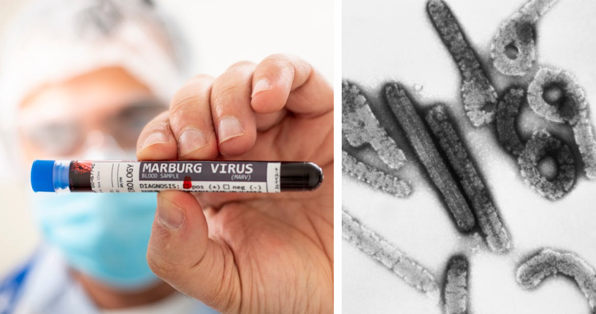 Virus Marburgo