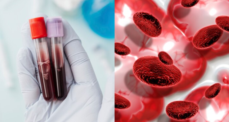 ¿Por qué es importante conocer si tu grupo sanguíneo es positivo o negativo?