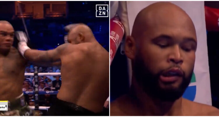 fractura Frazer mandíbula