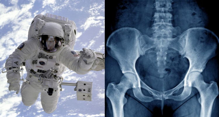 ¿Por qué cuando los astronautas regresen de Marte podrían romperse la cadera?
