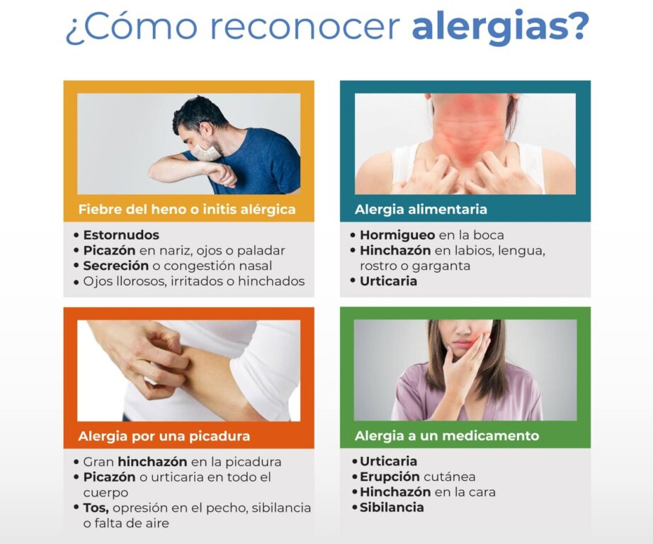 ¿Cómo reconocer alergias?