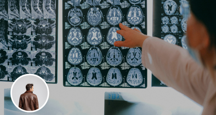 Un estudio reveló que el cerebro de un hombre disminuye su volumen constantemente en el transcurso de cada día y luego se reintegra en la noche