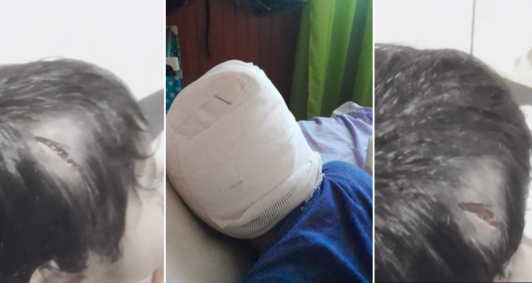 Niño de 3 años quedan con lesiones tras ser atacado por perro dentro de terminal de Collipulli