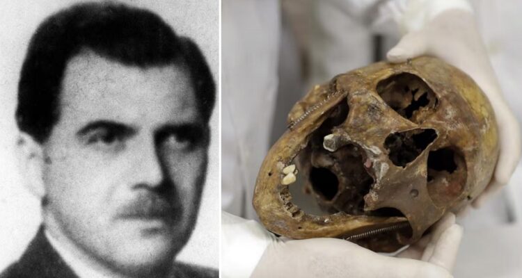 La calavera de Josef Mengele