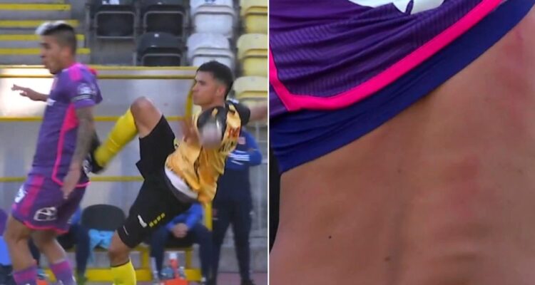 La U Leandro Fernández