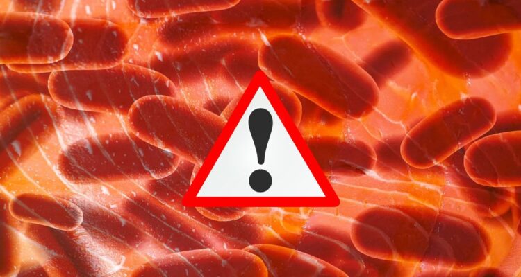 Qué es Listeria y cuáles son los 4 productos comercializado en Chile que cuentan con Alerta Alimentaria por presencia de bacteria y cuáles son los síntomas.