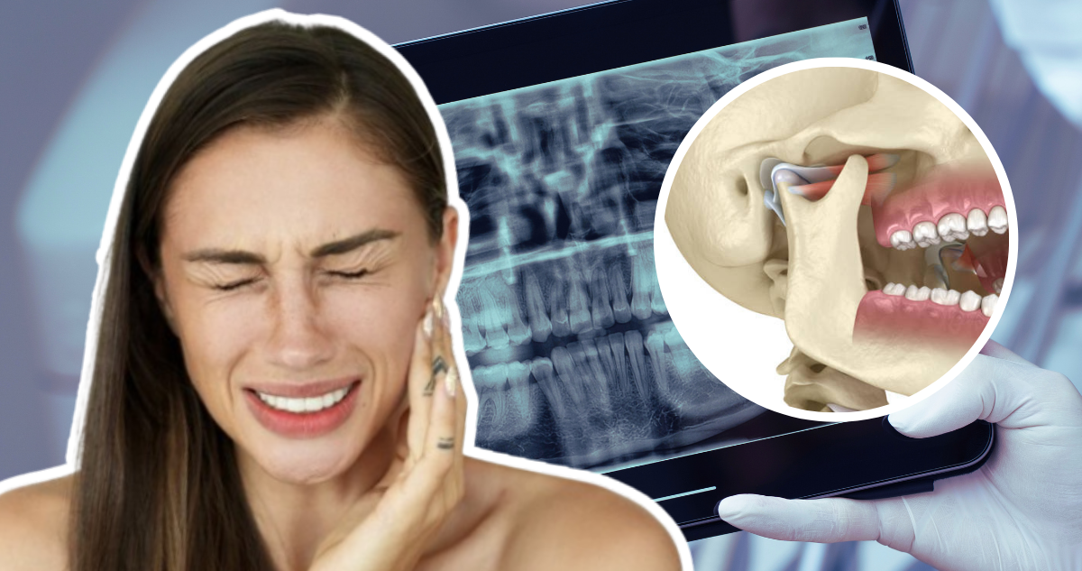 ¿Dolores fuertes en tu oído? Cuidado, podría ser un trastorno de la articulación temporomandibular