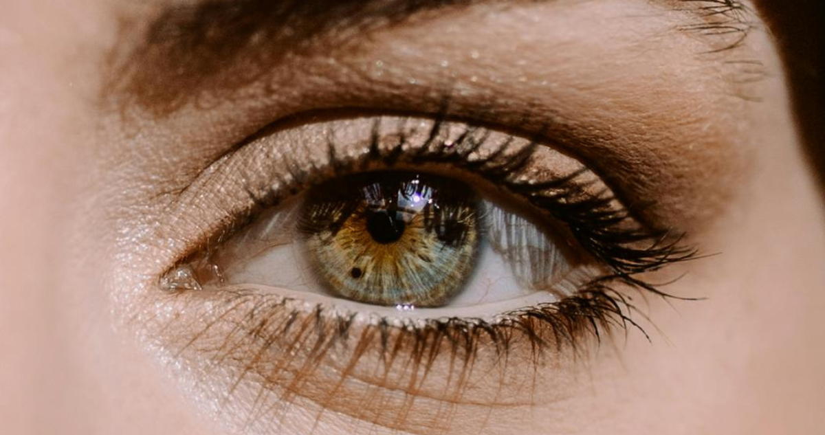 pecas ojos melanoma