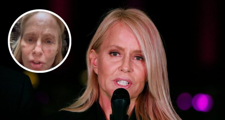 Cecilia Bolocco en evento y fotografía de lesiones en su rostro que la restarían de la Teletón