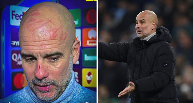 Pep Guardiola lució heridas en conferencia de prensa.