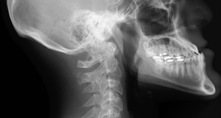 Radiografía del cráneo y boca para ilustrar nota sobre el obelisco