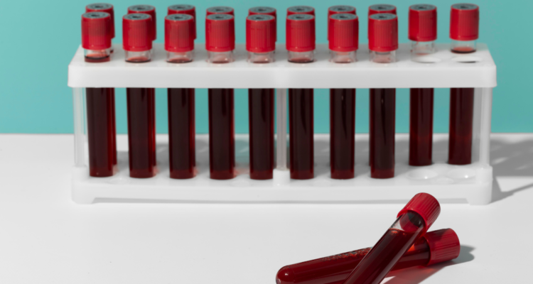 Estos son los tipos de sangre con más prevalencia a desarrollar enfermedades según estudio