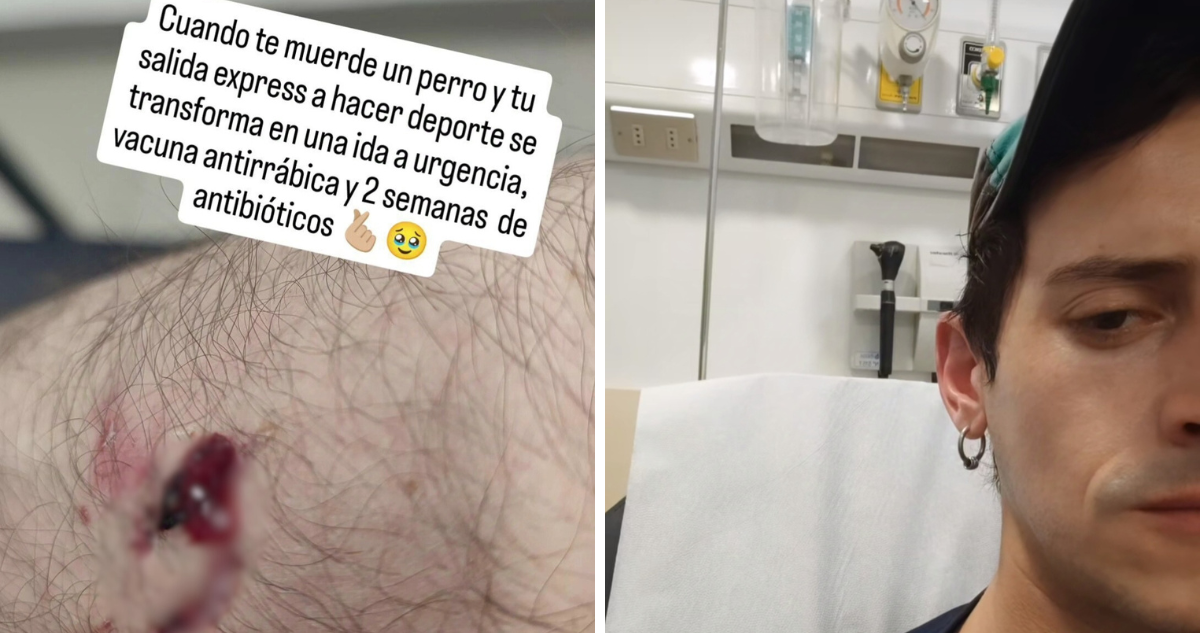 Actor, José Antonio Raffo, debió acudir a urgencias tras ataque de un perro mientras hacía deporte