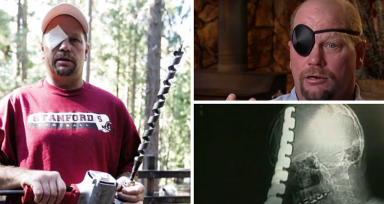 El increíble caso del hombre que sobrevivió al impacto de una broca de 45 cm en su cabeza