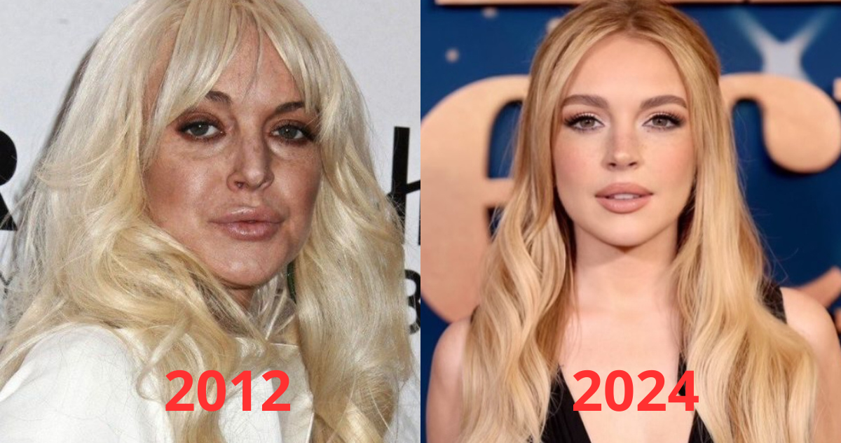 Comparación de Lindsay Lohan en referencia a procedimientos estéticos