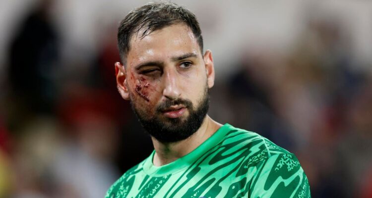PSG reveló detalles del presente de su arquero Donnarumma tra sufrir feo pisotón ante Mónaco