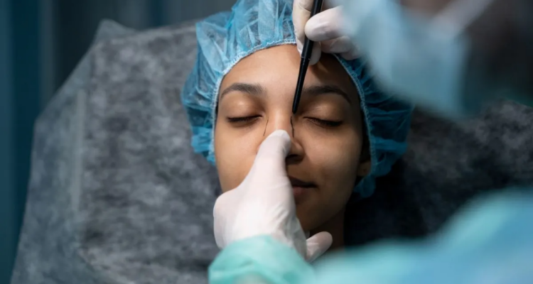 ¿Estás pensando en hacerte una rinoplastia? Esto es lo que necesitas saber