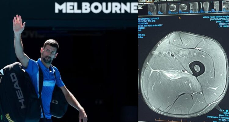 Djokovic y la imagen de su lesión en Australia