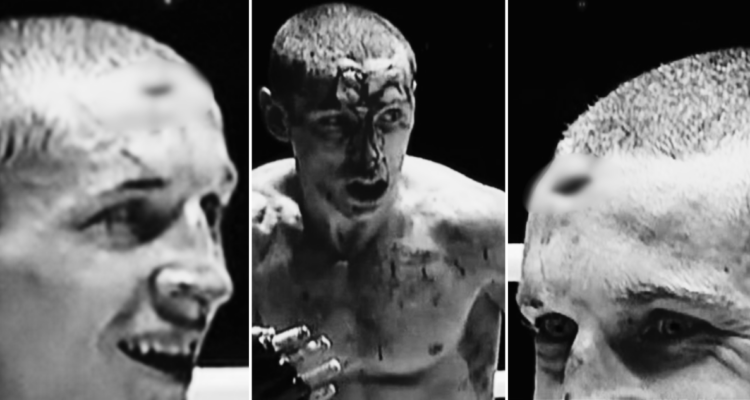 Luchador ucraniano terminó con un agujero en la frente en brutal combate de Muay Thai.