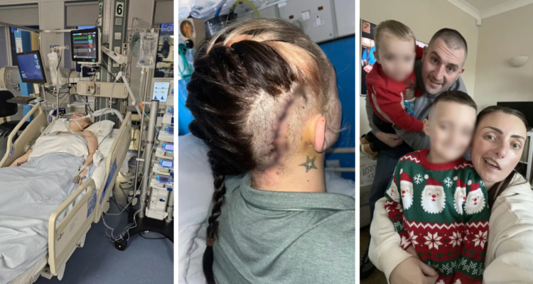 Mujer creyó que tic en su ojo era por estrés, pero en realidad era un tumor cerebral