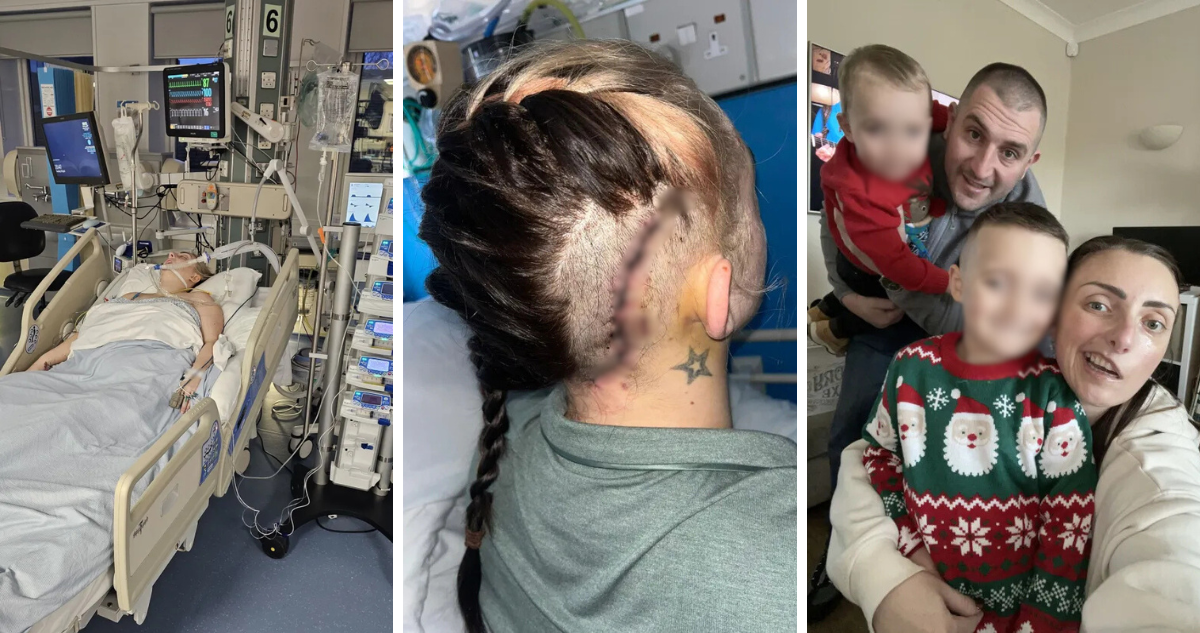 Mujer creyó que tic en su ojo era por estrés, pero en realidad era un tumor cerebral