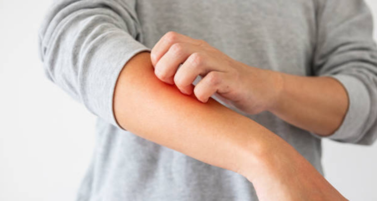 La ciencia responde si es bueno rascarse o no