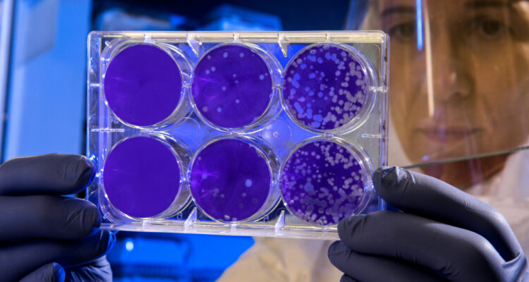 Imagen referencial de un laboratorio con bacterias