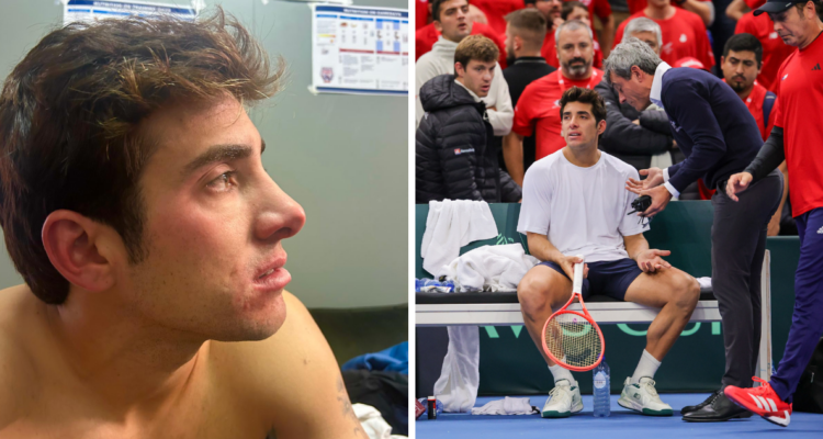 Así quedó el rostro de Cristian Garin por agresión en Copa Davis ante Bélgica: “Nunca vi algo así”
