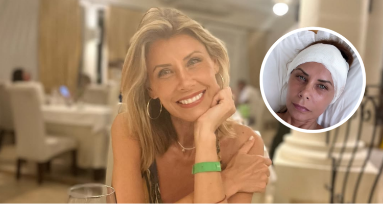 Mariel Aereboe en referencia a accidente que sufrió con quitasol