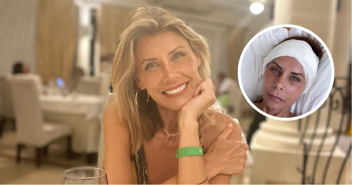 Mariel Aereboe en referencia a accidente que sufrió con quitasol