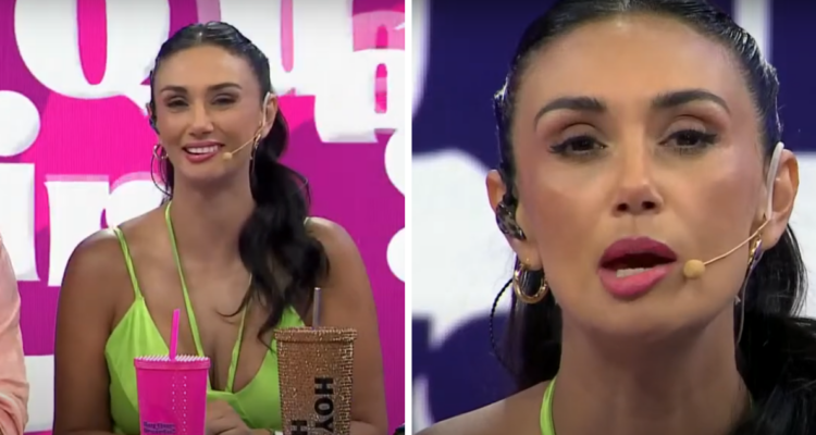 ¿Qué es una parálisis facial y cómo se puede tratar? Lo sufrió Pamela Díaz durante programa en vivo