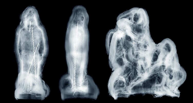 rayos x falso historico