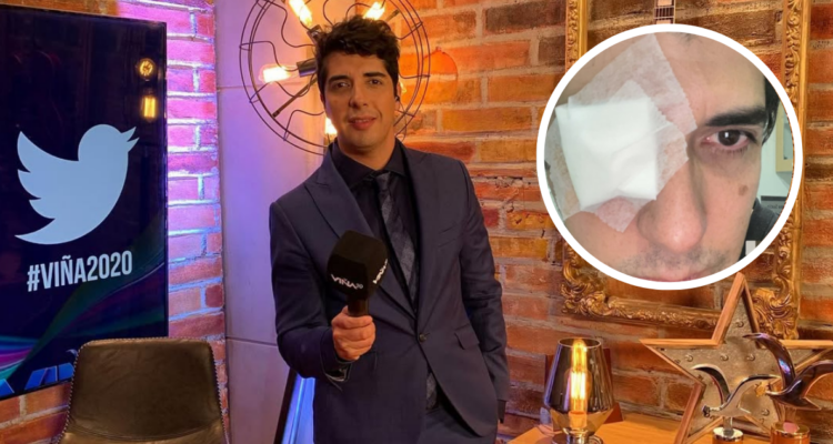 Roberto Van Cauwelaert, ex periodista de TVN, en referencia a accidente jugando Pádel