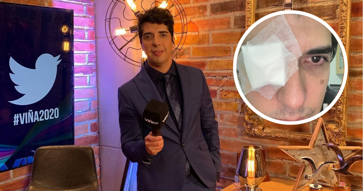 Roberto Van Cauwelaert, ex periodista de TVN, en referencia a accidente jugando Pádel