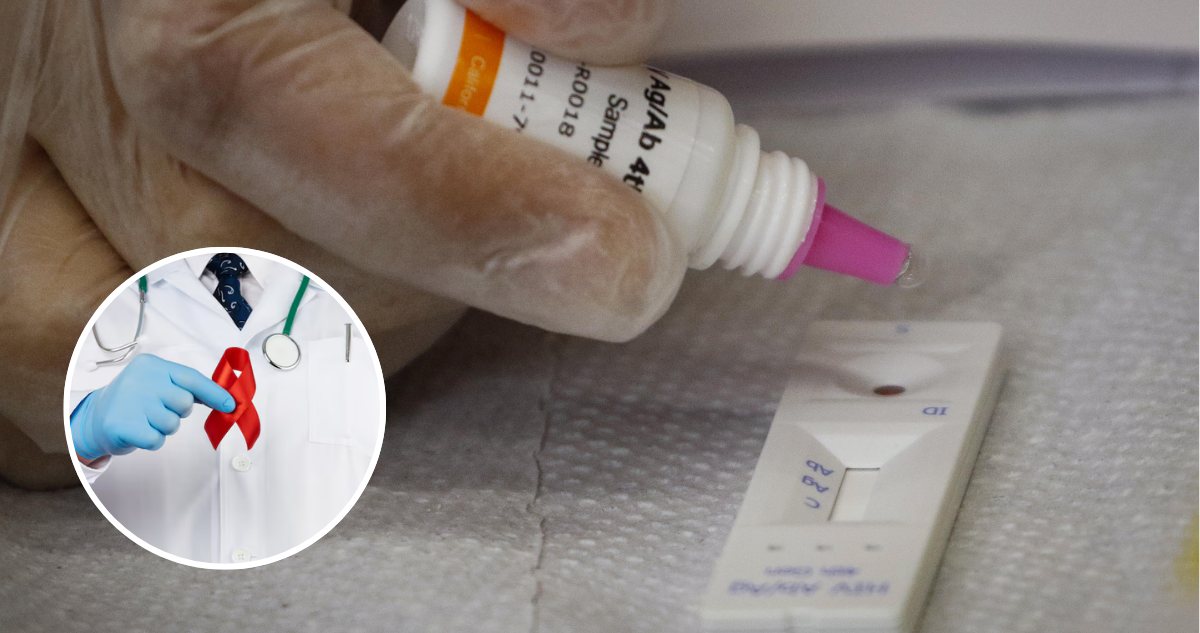 En qué consiste el test rápido de VIH, cómo funciona y dónde acceder de forma gratuita