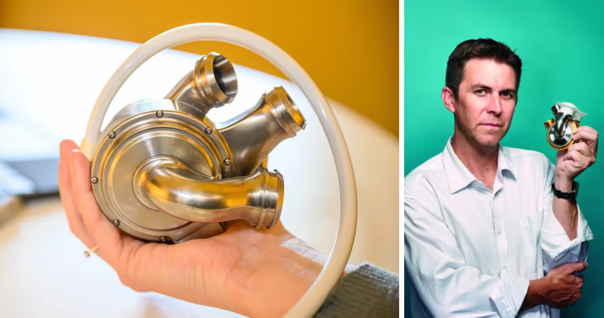 Australiano sobrevivió 100 días con un corazón artificial de titanio mientras esperaba un donante
