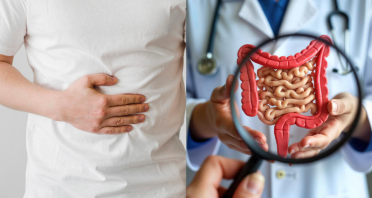 Cuáles son las causas del cáncer de colon: es la segunda enfermedad más frecuente en Chile