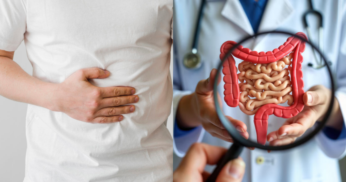 Cuáles son las causas del cáncer de colon: es la segunda enfermedad más frecuente en Chile