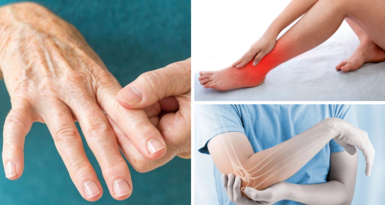 Científicos realizan estudio pionero para encontrar la cura de la artritis reumatoide