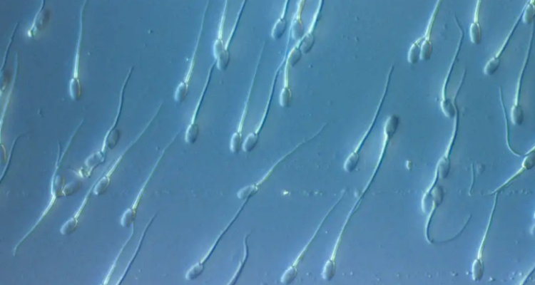 Imagen de espermatozoides por estudio que analiza calidad de semen en grupo de hombres